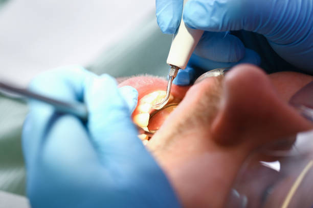 Best Orthodontic Emergency Dentist in Point Clear, AL